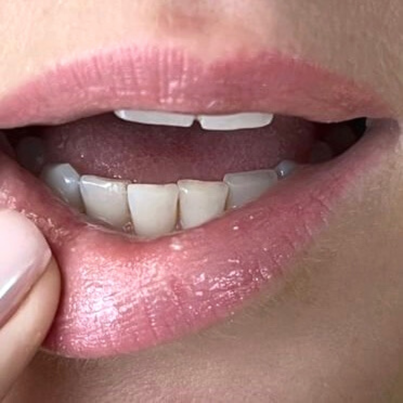 marie-brocart-balsam-maslo-do-ust-z-brokatem-drobinkami-bioglitter-powiekszajacy-objetosc-usta-ust-plump-plumping